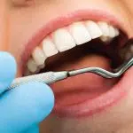 implant dentaire